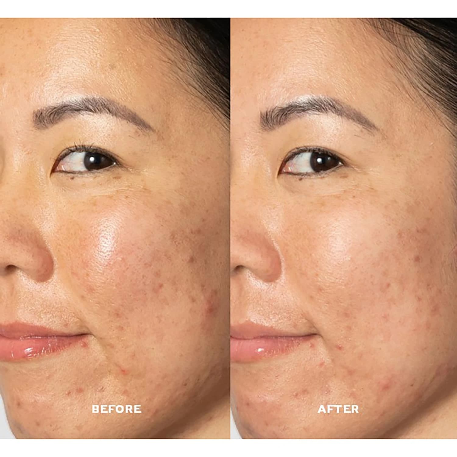 GLOW 2OH DARK SPOT TONER — foto 3